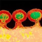 Lần đầu giải mã được cấu trúc bên trong virus HIV