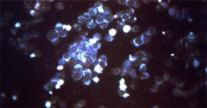 Đức cảnh báo loại virus đang lây lan “nguy hiểm hơn cả Covid-19”