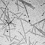 Virus đầu tiên được giới khoa học phát hiện là gì?