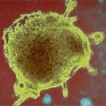 Virus sởi có thể chữa được ung thư?