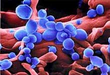 Lần đầu tiên công bố bức ảnh về virus cúm gia cầm