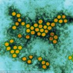 Virus mới gây ra tình trạng tê liệt ở trẻ em
