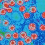 Dùng vi rút Herpes để điều trị ung thư