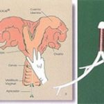 Đặt vòng cho bò để tăng năng suất sản xuất thịt