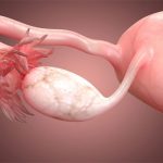 Một hiện tượng lạ vô cùng nguy hiểm với nữ giới mà không phải ai cũng biết