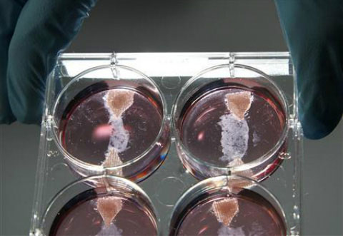 Xúc xích có thể gây biến đổi gene